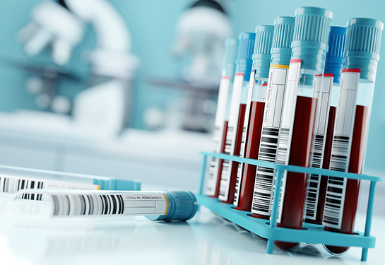 Test tubes filled with blood in a lab.